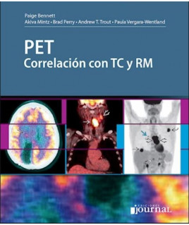 PET- Correlación con TC y RM