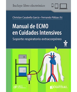 Manual de ECMO en cuidados...