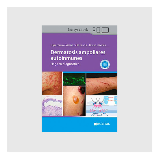 Dermatosis ampollares...