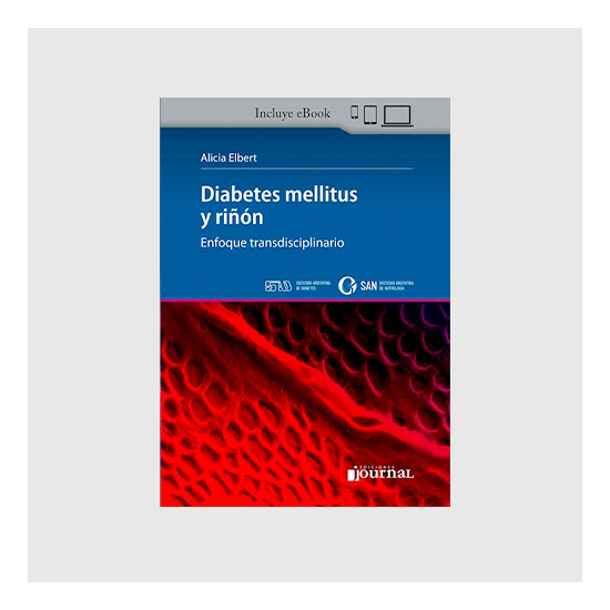 Diabetes mellitus y riñon