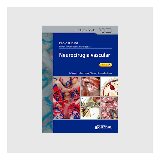 Neurocirugía vascular