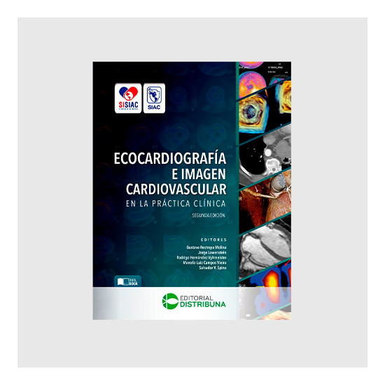 Ecocardiografía e imagen...