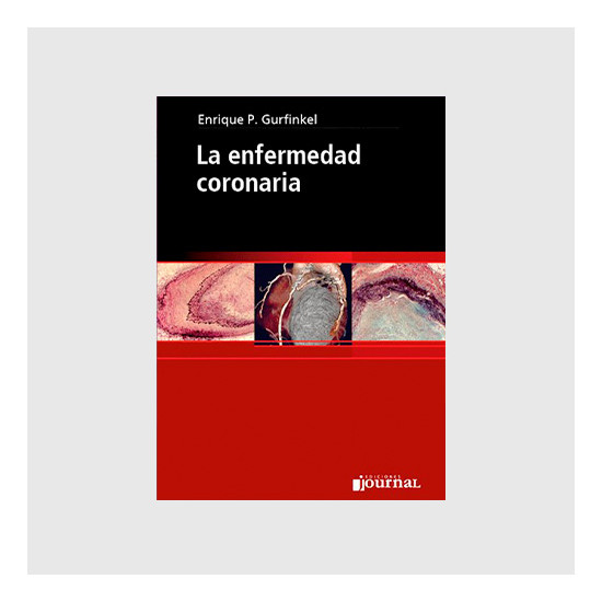 La enfermedad coronaria