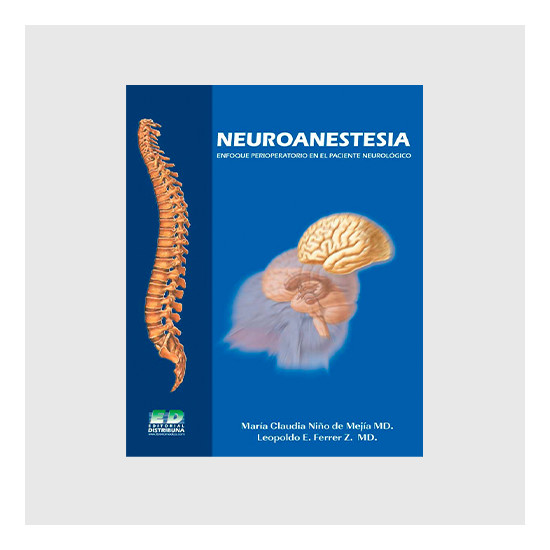 Neuroanestesia. Enfoque...