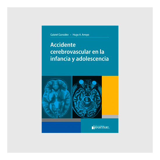 Accidente Cerebro vascular...